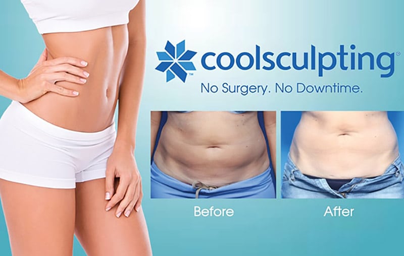 Cool-Scuplting-3 coolsculpting sydney
