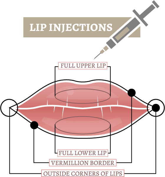 lip injections sydney