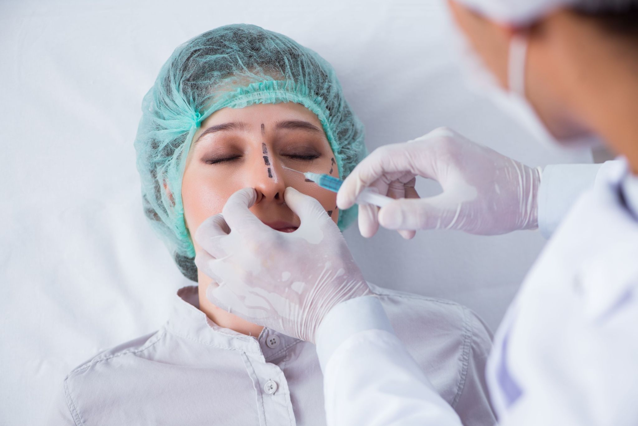 dermal nose fillers dermal nose fillers