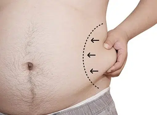 lipo for men lipo for men