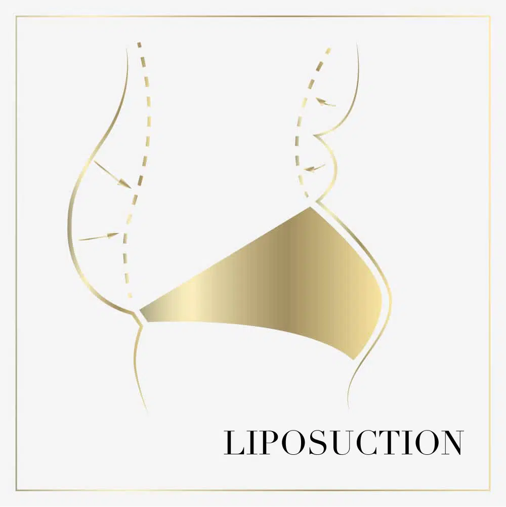 liposuction