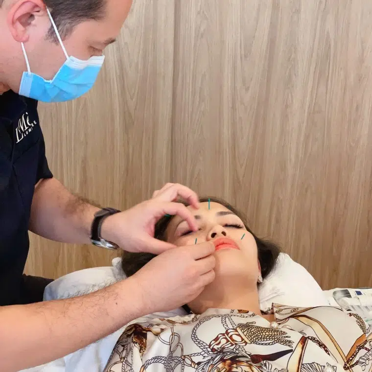 acupuncture treatment by Lumiere Beauty Clinic(3) (1) acupuncture treatment by Lumiere Beauty Clinic