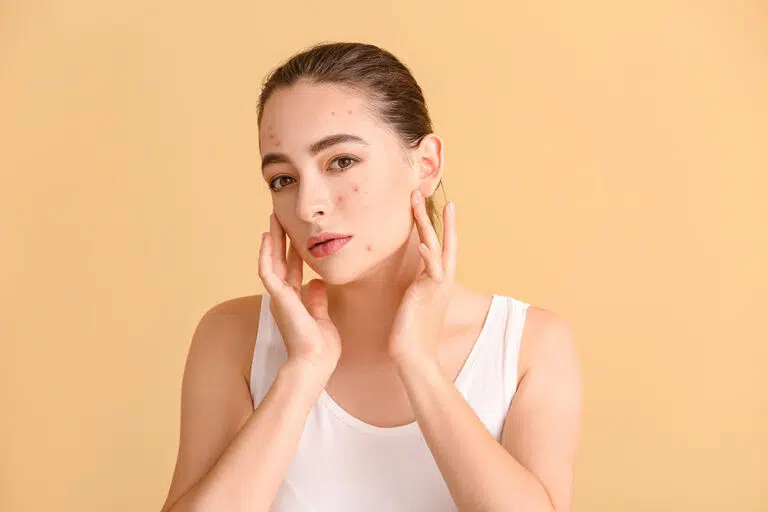 What does stress do to skin and how can you alleviate it