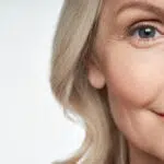 Treatment for Ageing Skin | Facial Rejuvenation Treatments